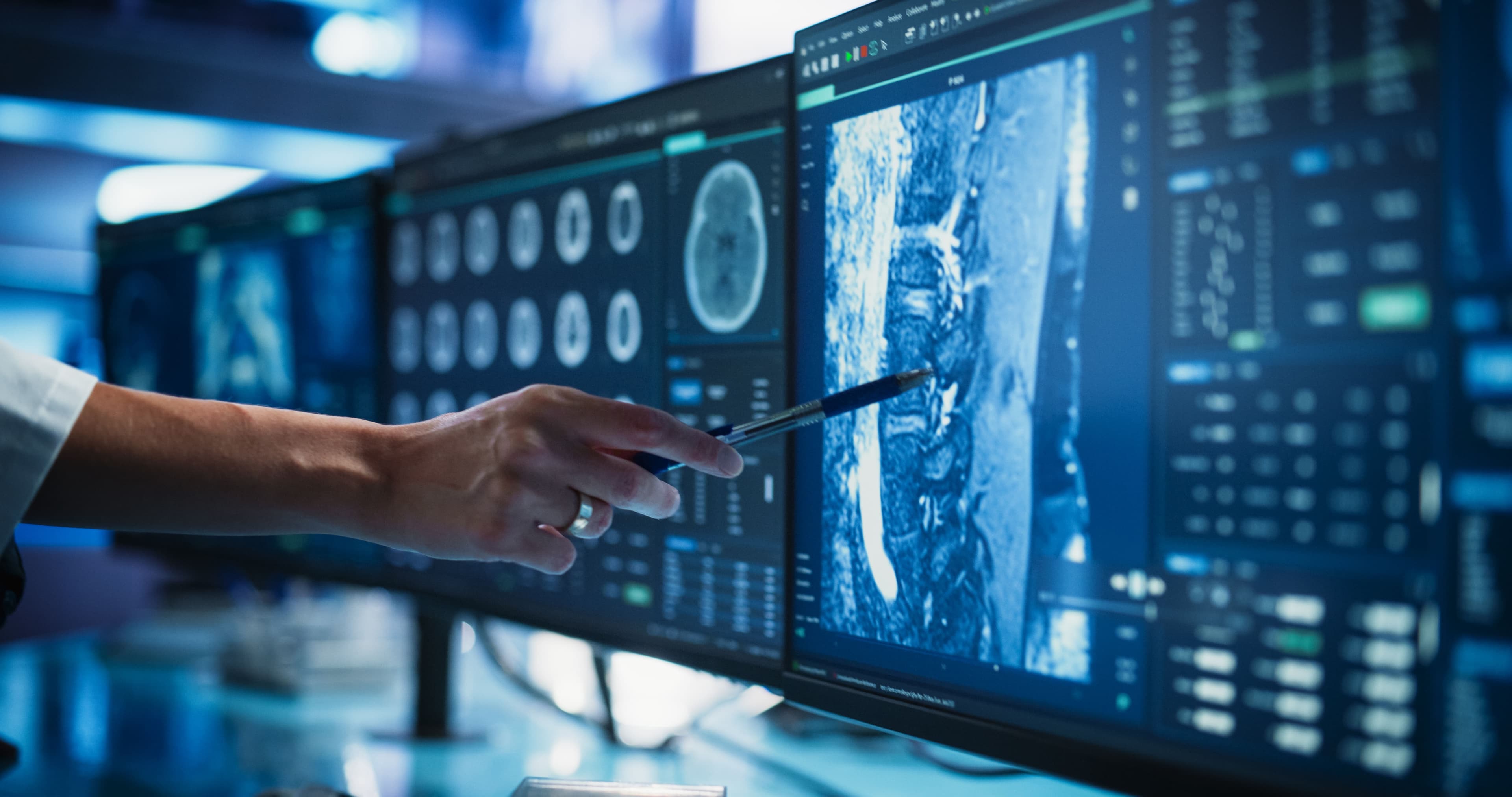 Accurate and Fast Radiology